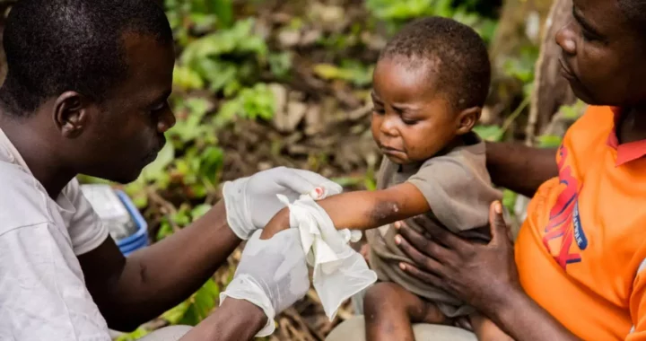 Maladie rare d’Afrique, la variole de singe se manifeste entre autre par des symptômes de fièvres, frissons, éruptions cutanées, des lésions sur le visage ou les organes génitaux